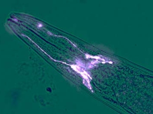 The head of a roundworm