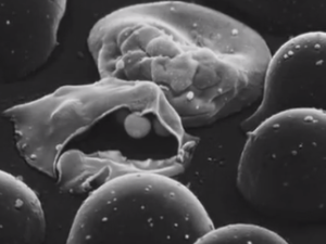 black and white microscopic view of cells